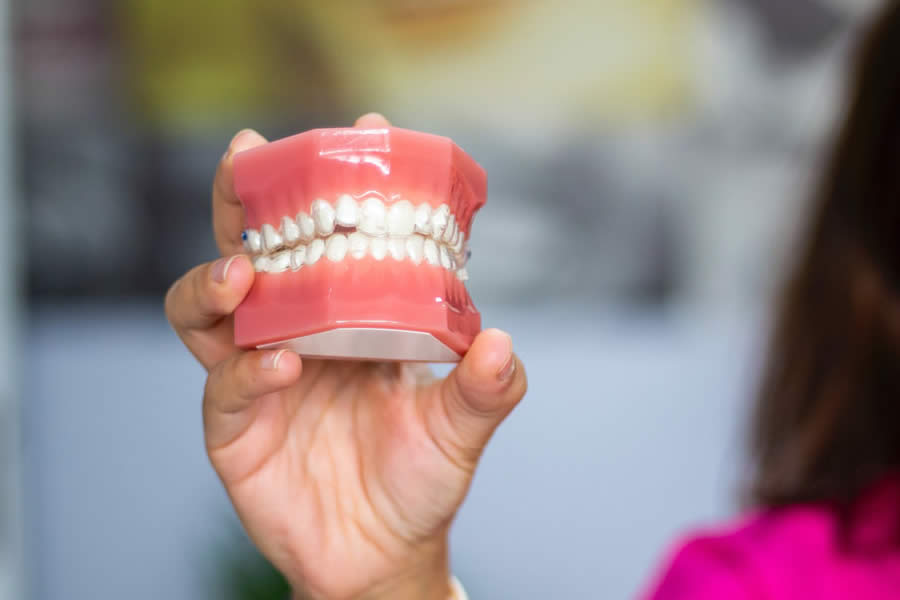 Şeffaf Plak Tedavisi Ne Kadar Sürer?